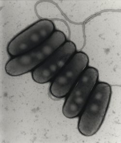 Bakterie Legionella – detail